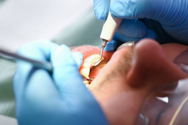 Best Emergency Dentist for Lost Fillings or Crowns in North Seekonk, MA