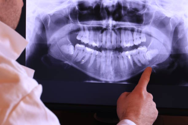 Best Emergency Cosmetic Dentistry in North Seekonk, MA