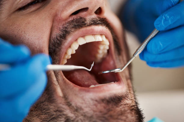 Best Emergency Cosmetic Dentistry in North Seekonk, MA